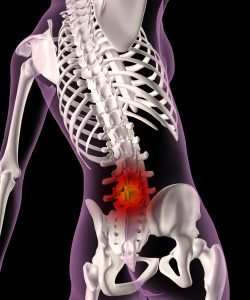 Chiropractic Tips For Avoiding Back Pain