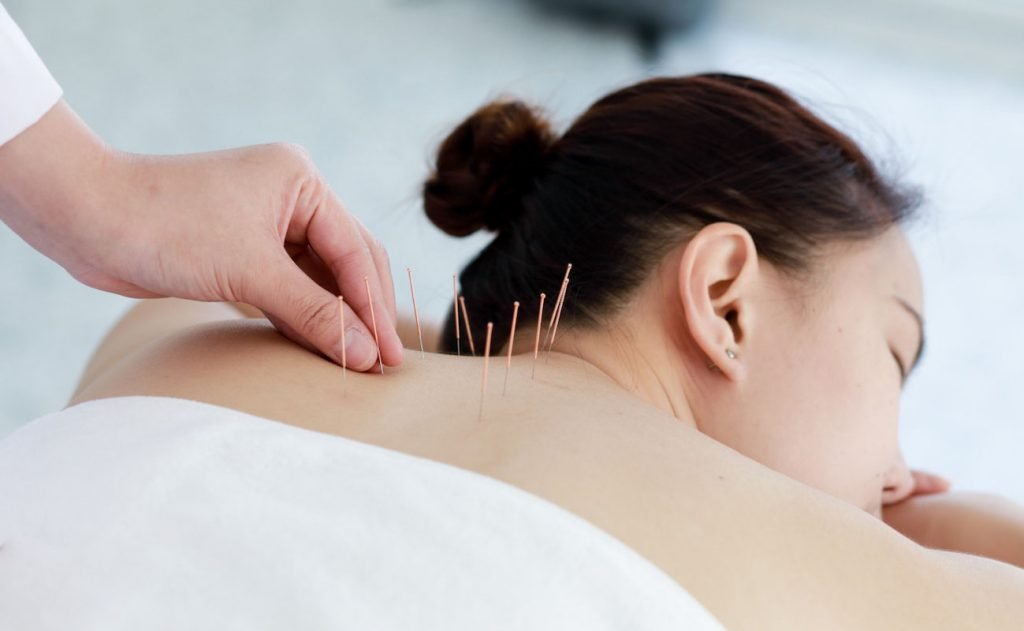acupuncture now available